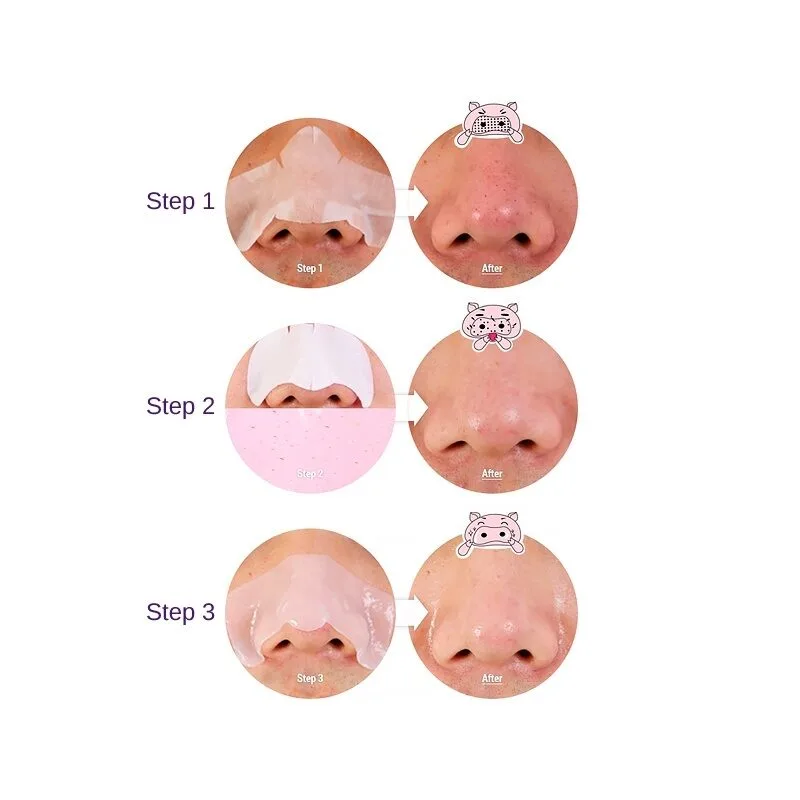 Holika Holika Pig Nose Clear Blackhead 3 Step Kit – poras valantys pleistriukai · 2